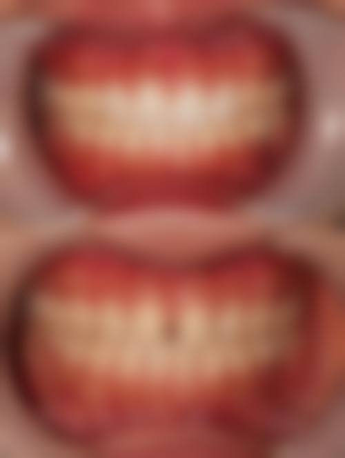 患者真实评价:哈尔滨淇奥口腔医院孙洪蕊