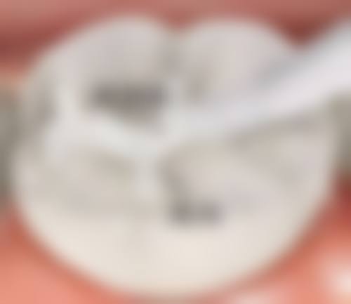 诊疗特色总结:哈尔滨淇奥口腔医院孙洪蕊