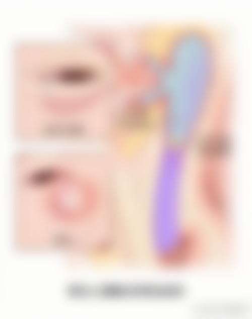 临床实例分享：真实反馈见证治疗成效