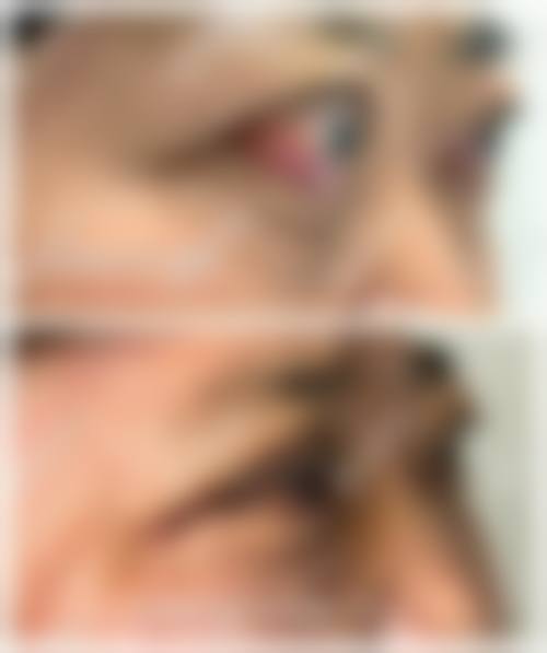 医生资质介绍:济南市中 心医院眼科程继民靠谱吗