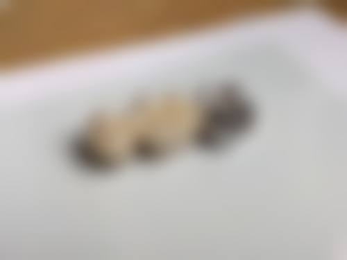 临床实例分享