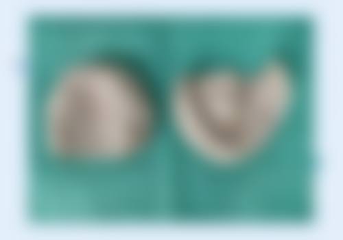 常见问题解答