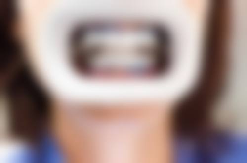 专精团队与贴心服务,全程守护口腔健康