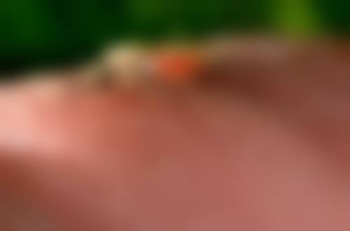 擅长项目详解:朱世广医生的核心技术