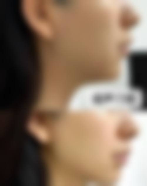 擅长项目详解