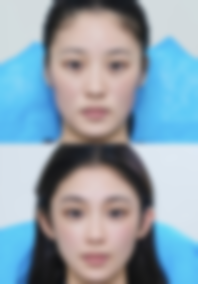 临床实例分享