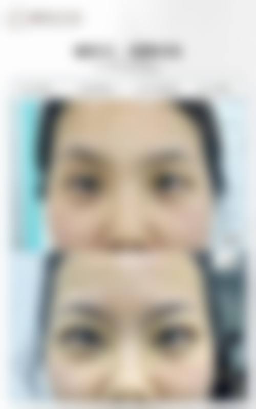 临床实例分享