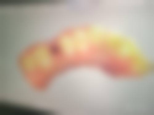 擅长项目详解