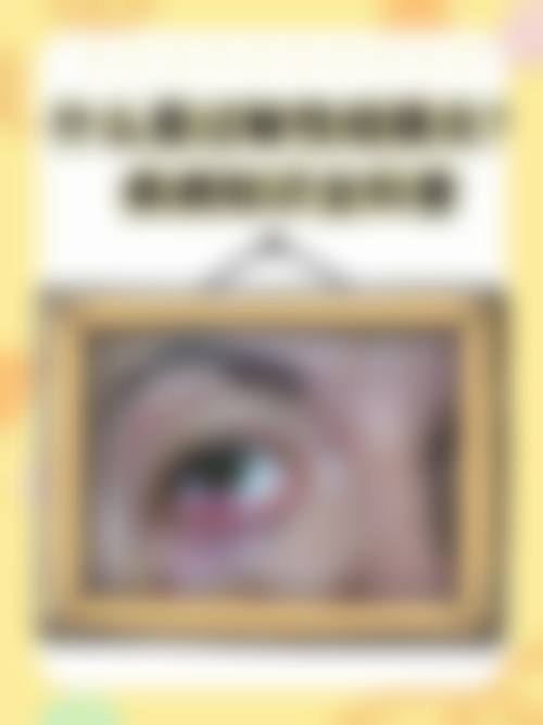 擅长项目详解福州台江爱尔眼科门诊部任绍学