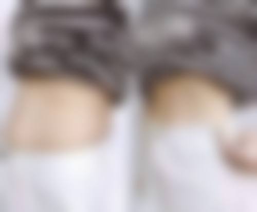 临床实例分享
