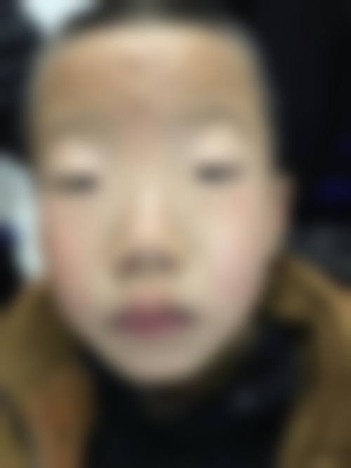 诊疗特色总结:为什么选择广西中 医 药大学附属瑞康医院眼科?