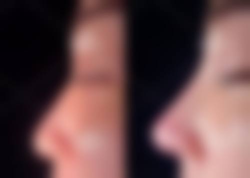FAQ:关于咸宁韩美整形美容医院周玉荣的常见疑问