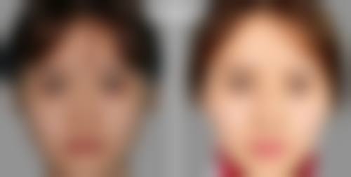 擅长项目详解:咸宁韩美整形美容医院周玉荣的技术强项