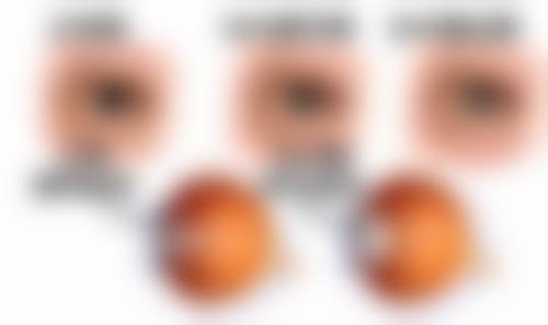 擅长项目详解:覃春燕医生核心诊疗方向