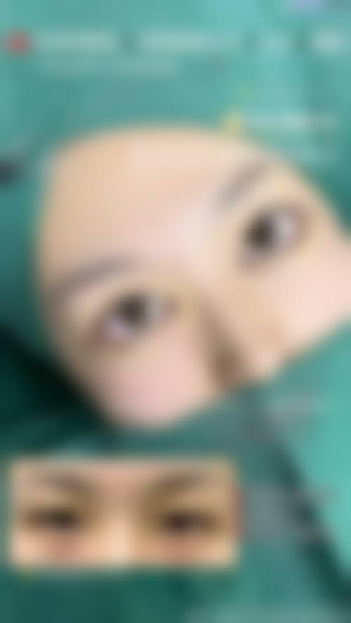患者真实评价：上海郑逸冰医疗美容医院的服务体验如何？