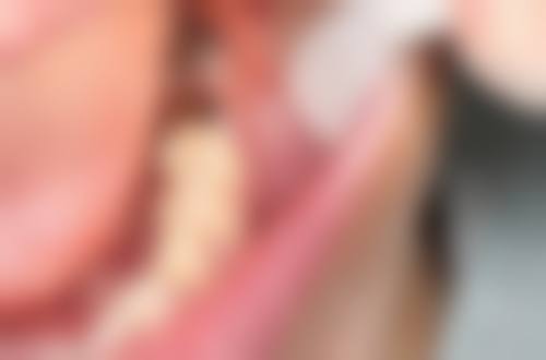 预约优惠活动:现在预约有什么补贴?