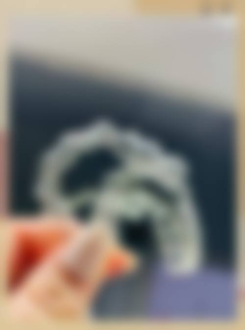 患者真实评价:口碑如何?