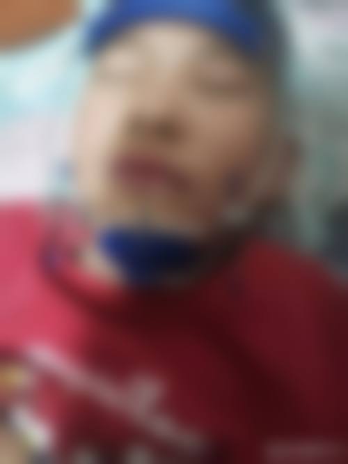 擅长项目详解：德阳市口腔医院杨庆医生技术