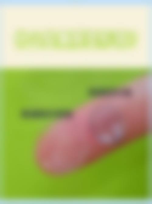 临床实例分享:真实患者的修复见证