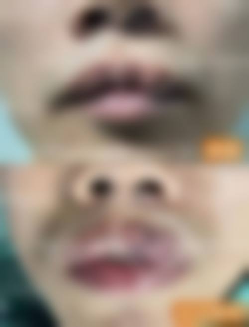 预约优惠活动