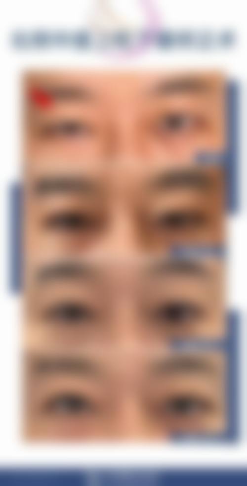 擅长项目详解