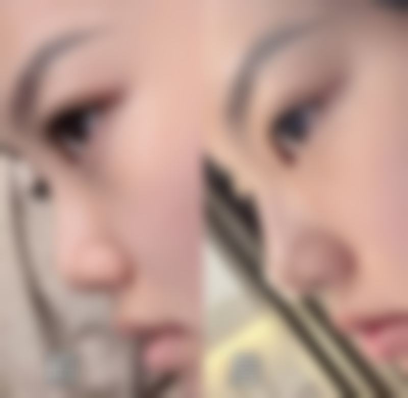 擅长项目详解