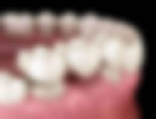 拔牙后24小时内:喝牛奶要格外注意温度