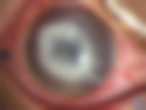 擅长项目详解：边广庆医生专注的眼科领域