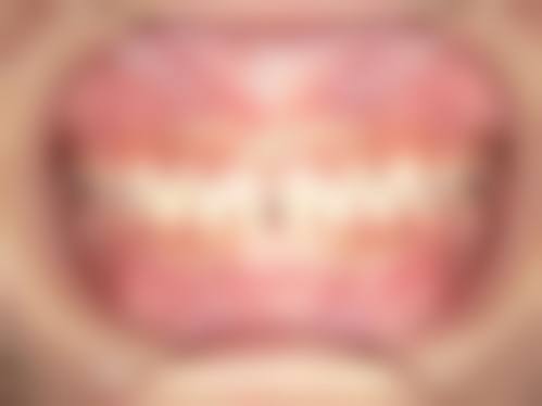 常见问题解答(FAQ)
