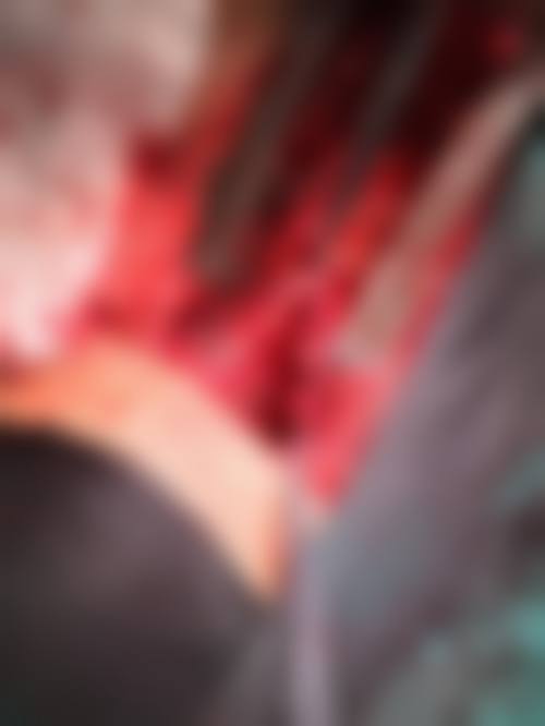擅长项目详解：青岛中科友信口腔诊所李振国