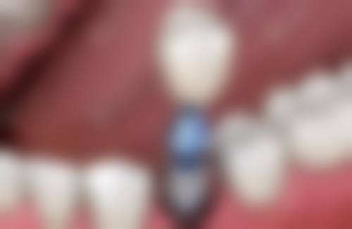 结尾预约号召：立即行动守护孩子笑容