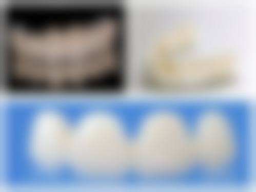 FAQ:常见问题解答