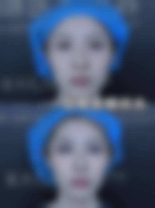 预约优惠活动