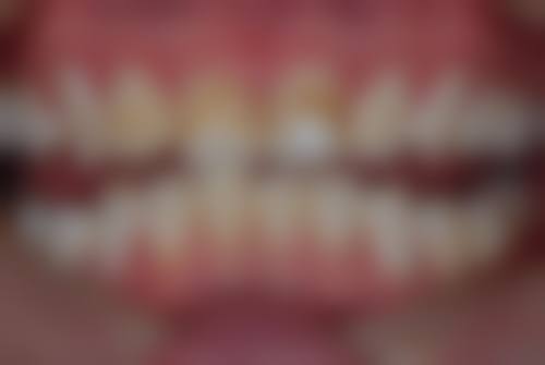 核心诊疗项目:数字化矫正与微创种植技术