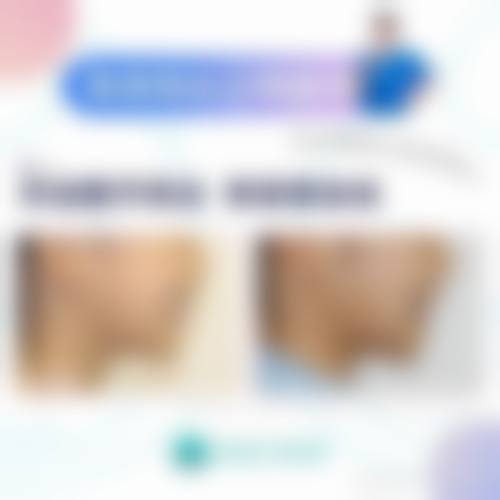 常见问题解答:快速了解就诊细节