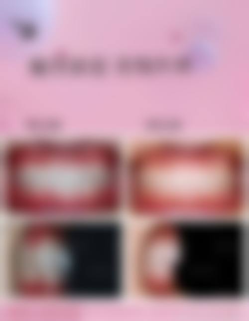 擅长项目详解:精细解决各类口腔难题