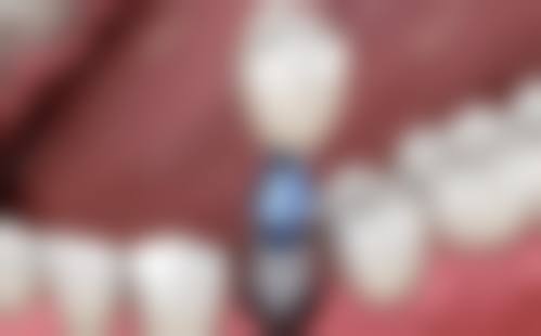常见问题解答与预约指南