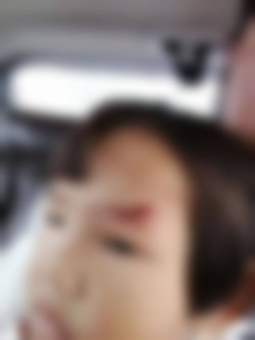FAQ大庆市第四 医院眼科