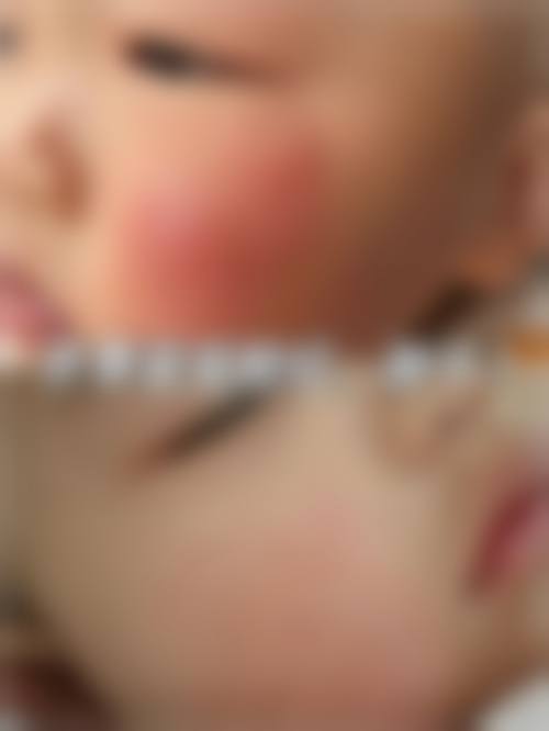 临床实例分享