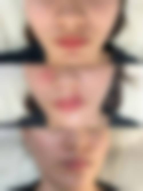 结尾预约号召北京医 科整形美容门诊部布仁