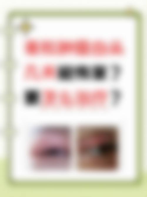 临床实例分享