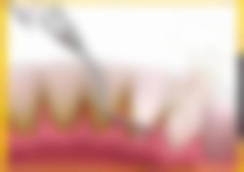 常见问题解答(FAQ):快速响应患者关切