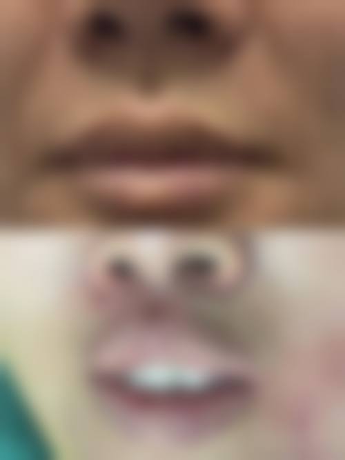 常见问题解答