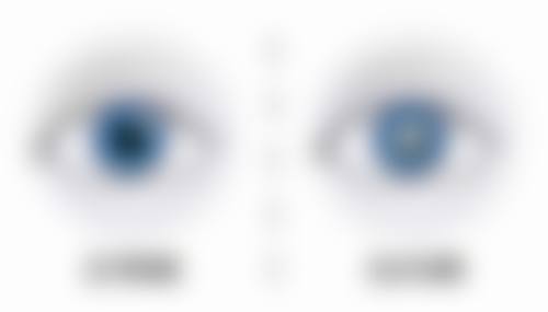 诊疗特色总结重庆大学附属三峡医院眼科万方
