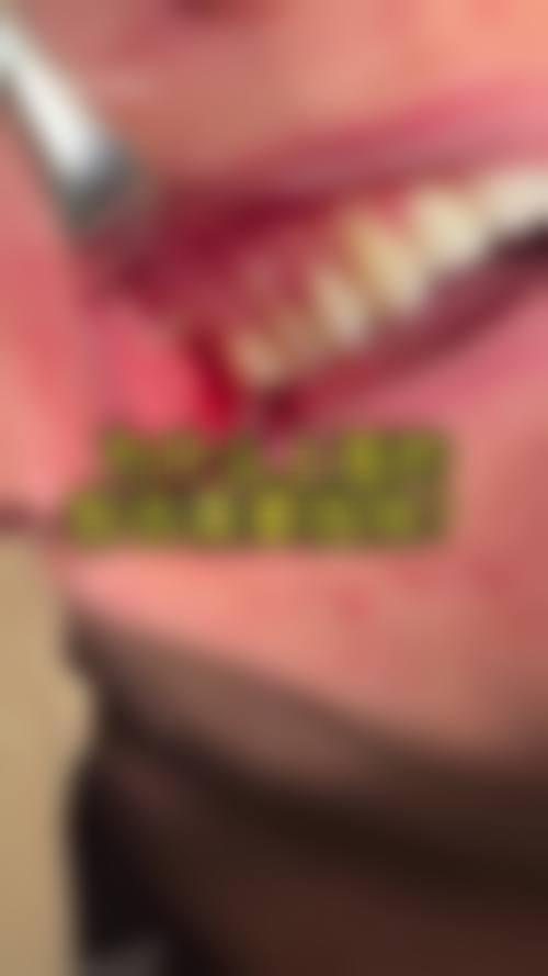 预约优惠活动：南昌维乐口腔（红谷滩万达分院）燕玲医生补贴