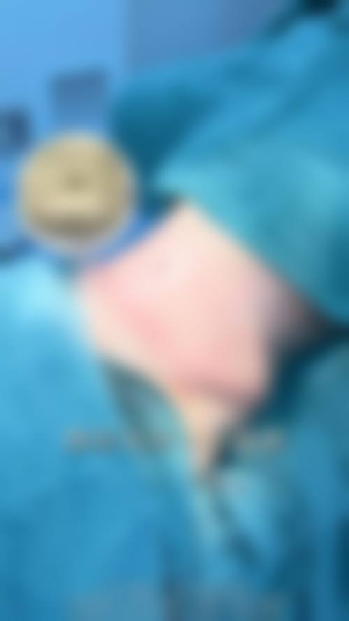 临床实例分享