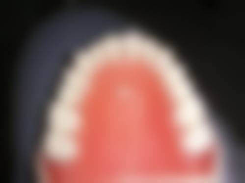 临床实例分享