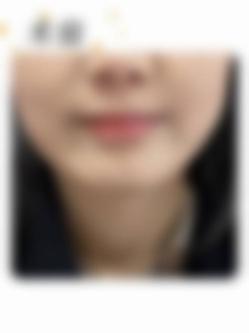服务项目与透明报价:高性价比方案助力美丽升级