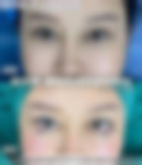 结尾预约号召:立即行动,重获清晰视界