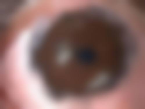 擅长项目详解:湘潭市第一人民医院眼科黄爱平的诊疗范围